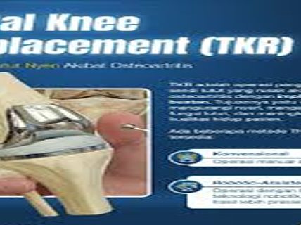 Teknologi Terbaru untuk Operasi Penggantian Lutut yang Lebih Presisi