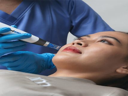 Pendekatan Medis dan Teknologi Laser Jadi Kunci Penanganan Melasma